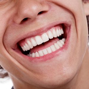 sonrisa-hombre