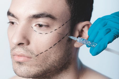 Mesoterapia facial hombre Mesoterapia facial hombre